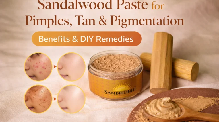 Sandalwood paste for pimples